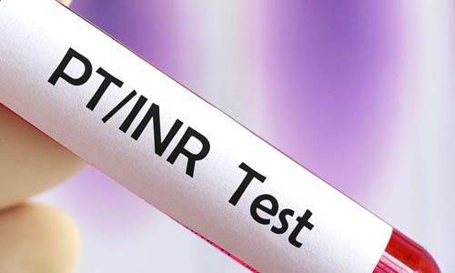 PT/INR test