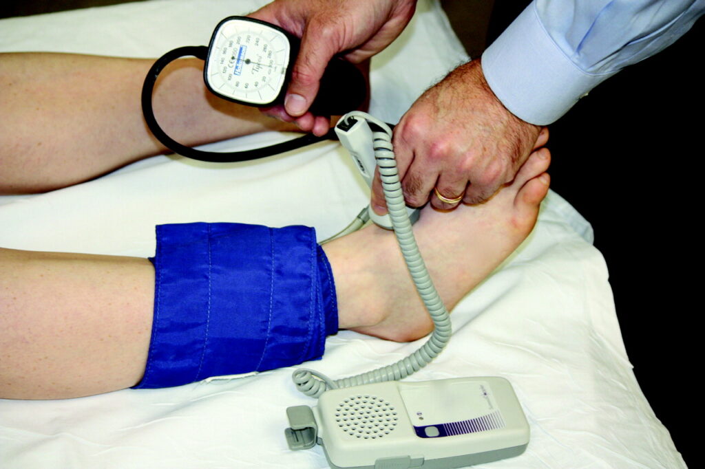Anticoagulation Machine, aortic valve replacement, Aortic valve stenosis, artificial heart valve, benefits of self testing, bioprosthetic valve replacement, cusps (tricuspid aortic valve), embolism, heart bypass, Heart failure, Heart Valve Disease, heart valve replacement, home inr, home inr testing, inr machine, inr self testing, inr test meters, inr test meters at home, leaky heart valve, Mechanical Heart Valve, mitral incompetence, mitral insufficiency, Mitral valve regurgitation, On-X Aortic Valve, Patient Self Testing, prosthetic heart valves, pt inr cpt code, pt inr home monitoring system, pt inr machine, pt inr test meter, PT/INR Patient Self Testing, Stroke, warfarin
