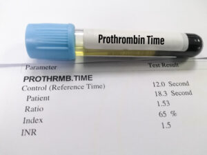 HOW DEHYDRATION OR ILLNESS CAN IMPACT YOUR INR LEVELS
